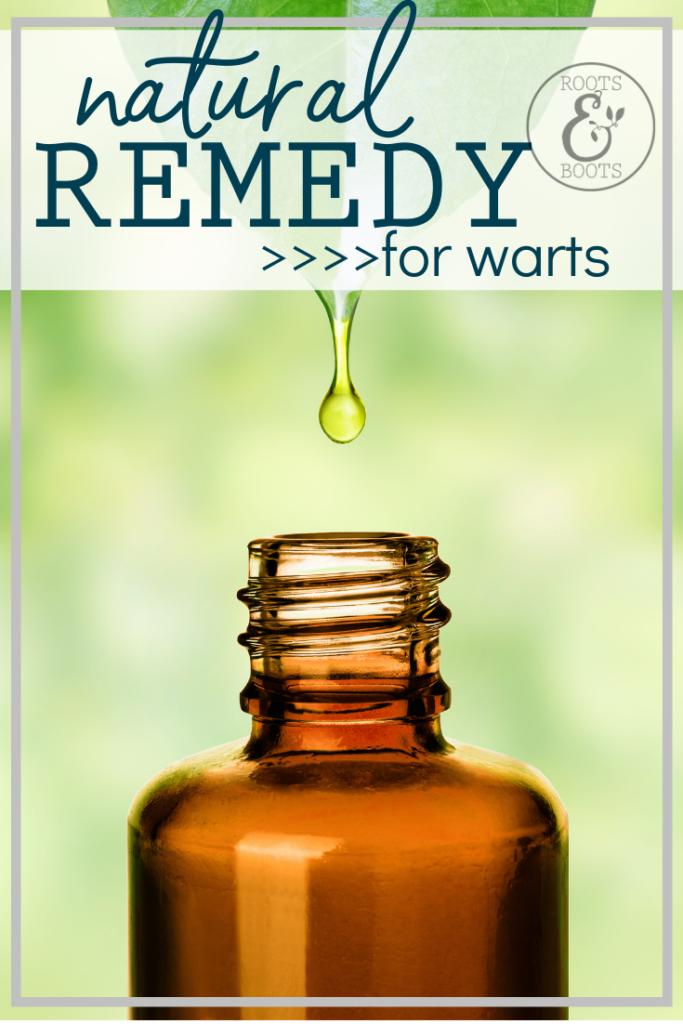 Essential Oils for Warts | Roots & Boots