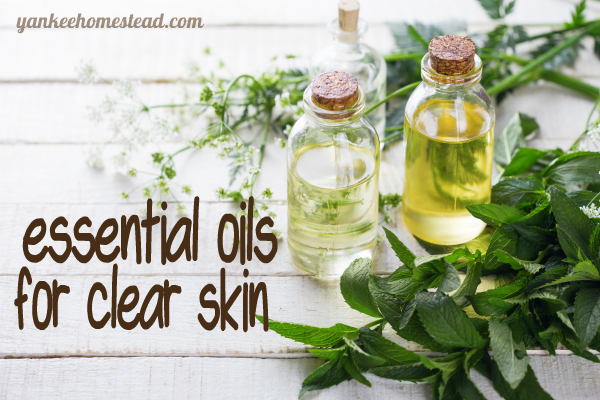 Essential Oils for Clear Skin